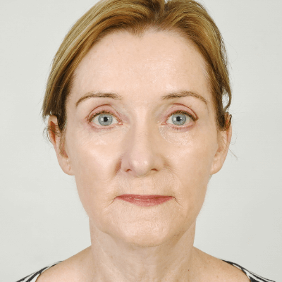 Lynn Scott